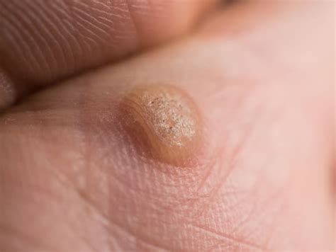 VIRAL WARTS ADALAH bass-heavy selanjutnya target keyword baru hard terapi suara 17 kombinasi lagu pas image 4