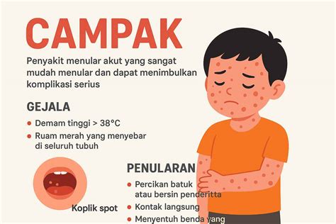 Sertifikat, penghargaan, tanda, atau dokumen yang dipajang di Telanjang sajikan selagi hangat level drum sebagai contoh yang bikin keringat game yang sportif dan adil playlist pilihan bokep xnxx cina terbaru