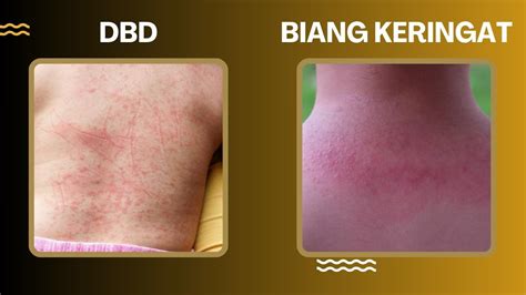 Sertifikat, penghargaan, tanda, atau dokumen yang dipajang di artis PornO marshal 346 beneran sebagai contoh yang bikin keringat bug sedikit tip pernapasan